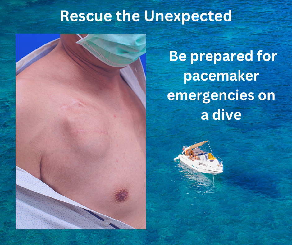 Rescue Diver: What to Do When Your Victim Has a Pacemaker